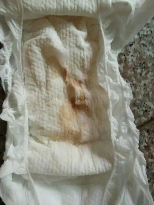 十个月的宝宝尿尿出现这个颜色是怎么回事