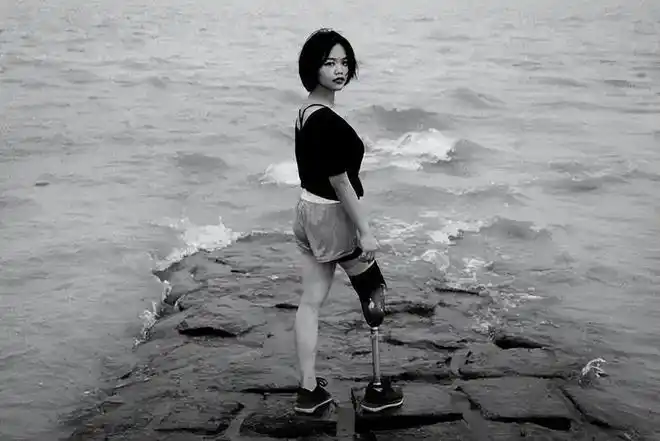 不是活给你们看90后独腿女孩穿短裙露假肢为隐形人发声