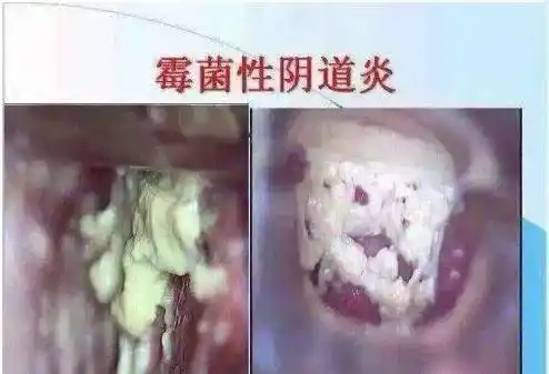 外阴_繁殖_局部