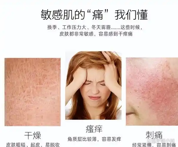 速看你肌肤敏感的原因找到了无外乎就是这四大点