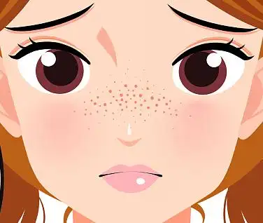 如何让脸部毛孔缩小2