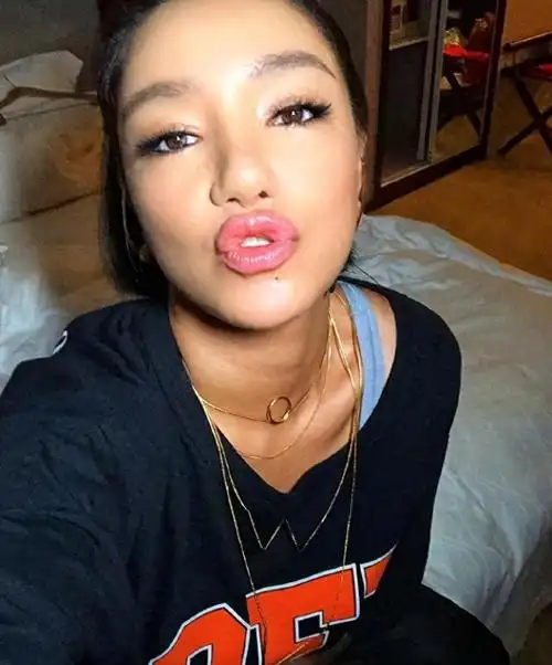 超女冠军江映蓉:过度医美后像"怪物",全身仅剩眼珠是自己的