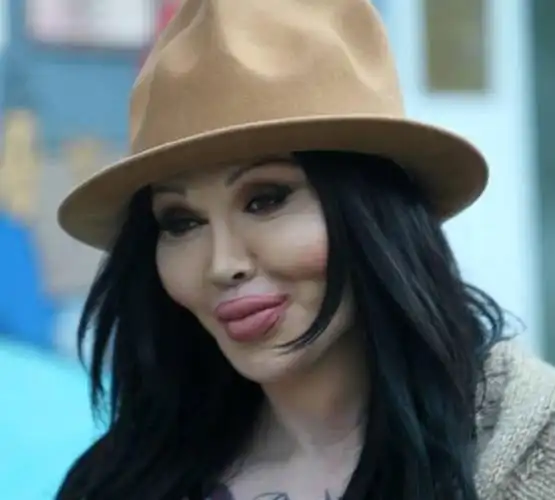 美女整容变电风扇大妈盘点整容失败惊悚案例