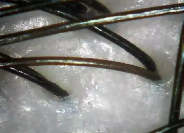 头皮知识科普||