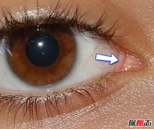 人类不需要的十个器官(不影响生活)