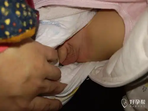 急急急宝宝小鸡鸡痒的厉害