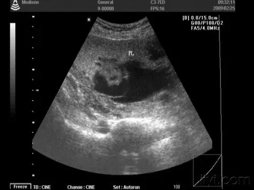 这是胎盘血窦吗?