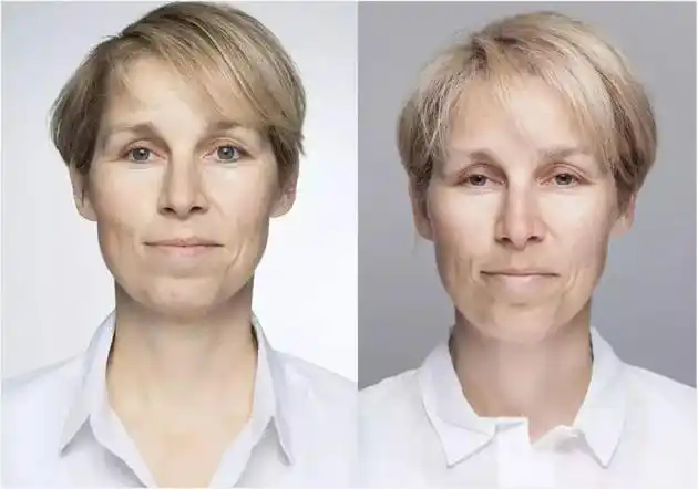 知否赵丽颖被嘲脸垮女星也难逃的熬夜脸怎么治