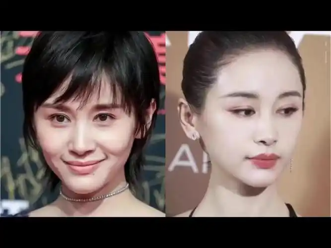 为什么王子文就适合做脂肪填充?#11月美学分析,我_圈子-新氧美容整形