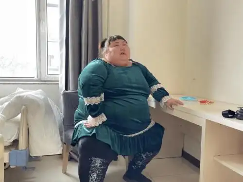 443斤超级肥胖女子在长春嘉和外科医院切胃减重,3个月减127斤_白女士