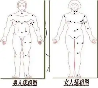 手臂有痣在相术中好不好 手臂上痣