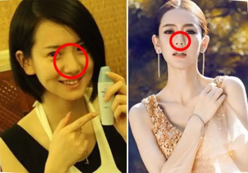 戚薇整容前后照片对比揭露她整了哪些部位