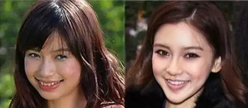 史上最全angelababy整容大揭秘!