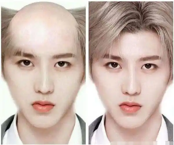 有一种岁月叫"秃头",蔡徐坤难逃此劫,张艺兴中招,而李易峰…_网易订阅