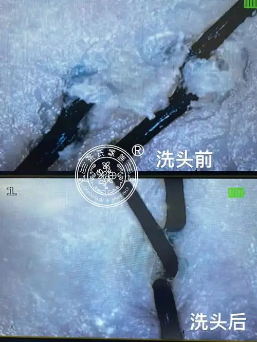 健康的头皮呈现