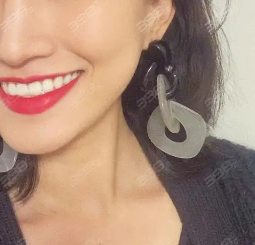 戴牙套刚开始真的不习惯,嘴巴也容易破,然后嘴角血流出来,搞得自己跟