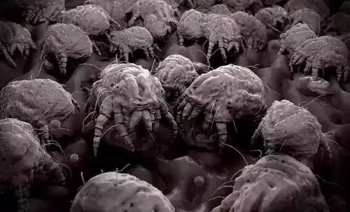 冬季不注意,600万螨虫陪你睡!过敏,哮喘换上它30天搞定!