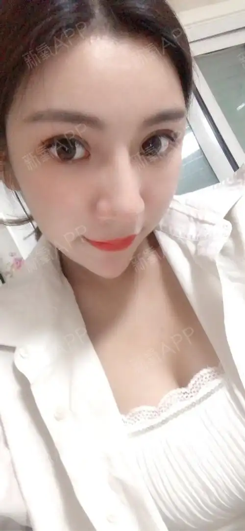 不管是外观还是手感都感觉不到隆过的痕迹,好喜欢现