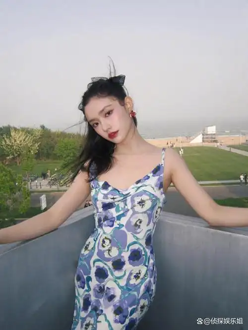 5月27日,演员林允在个人社交平台分享了一张自己做医美的照片.