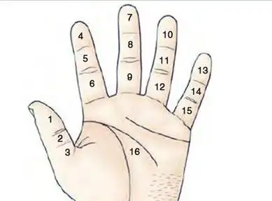 手指中间长痣,手指中间肿胀是什么原因