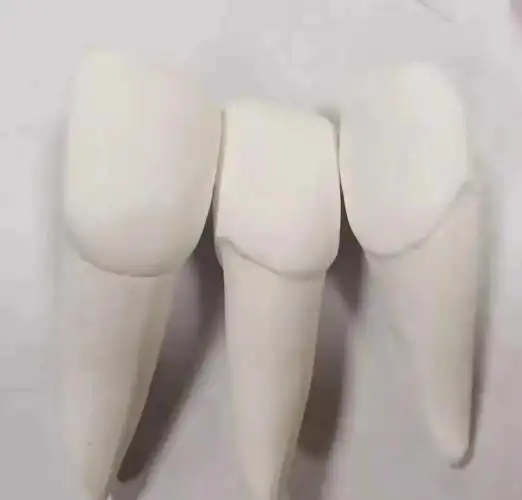牙齿模型