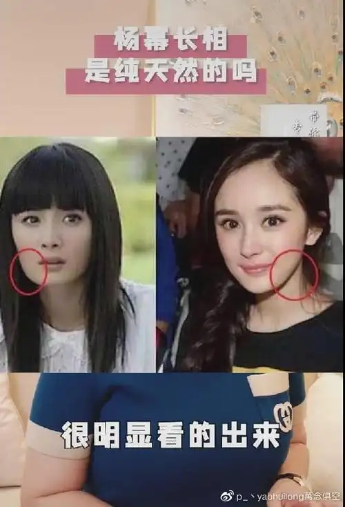 称杨幂的下颚角肯定是动过的,并放出了早年时期的对比照,从侧脸照就能
