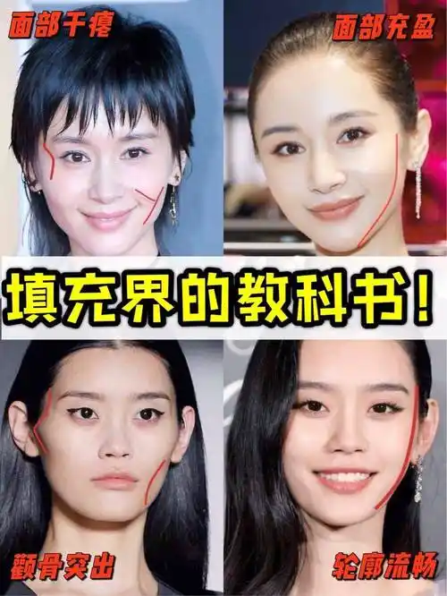 跟王子文学习面部填充大变活人实现逆龄神话