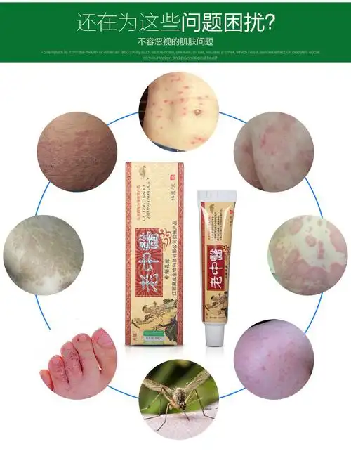 乳膏皮肤病全身皮炎膏皮肤瘙痒牛皮癣苗药膏王敖东 1盒(15克标准)