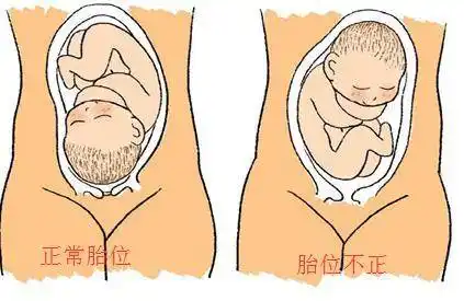 第一:胎位触摸方法在孕后期,基本上在28周以后,医院的检查中也会有