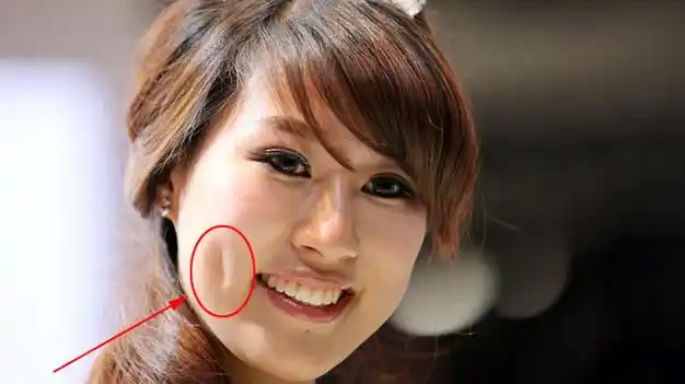 涨姿势,酒窝竟然可以分为4大类,你属于哪一种?