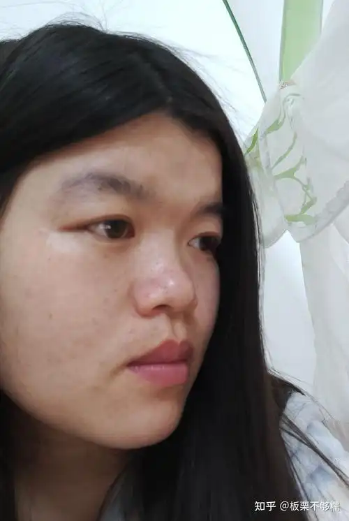 没有鼻梁鼻子塌的人是什么体验