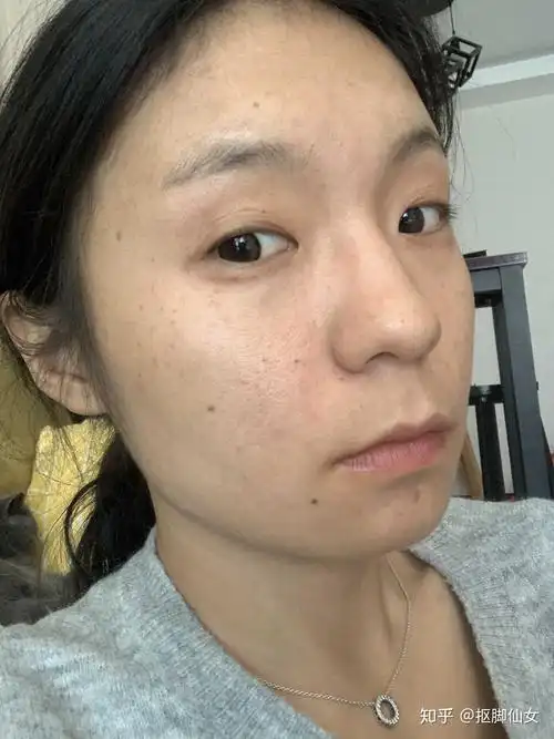 五官好看,皮肤差是种怎样的体验?