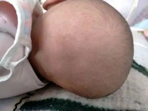 知道的宝妈请在线回复一下.后脑勺还有红色的小红点.