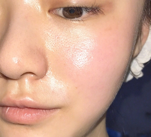 脸上毛孔"粗大肥胖",这4个原因是凶手,拯救毛孔只需3步骤