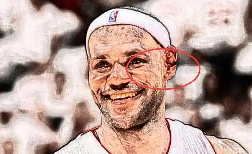 耳骨长痣耳骨长痣男人,一般耳骨都会外露,耳廓外翻,此处长痣的人,为人