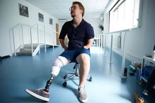 装上仿生假肢后他成了现实版的终结者和钢骨