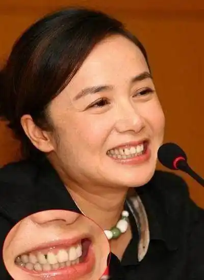 蒋雯丽应该不知道自己的牙里粘了菜渣,不然一定不会笑得这么灿烂,看得