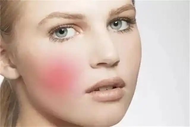 经常感觉干燥紧绷,并且感觉用什么产品都无法缓解;②皮肤脆弱,敏感,对