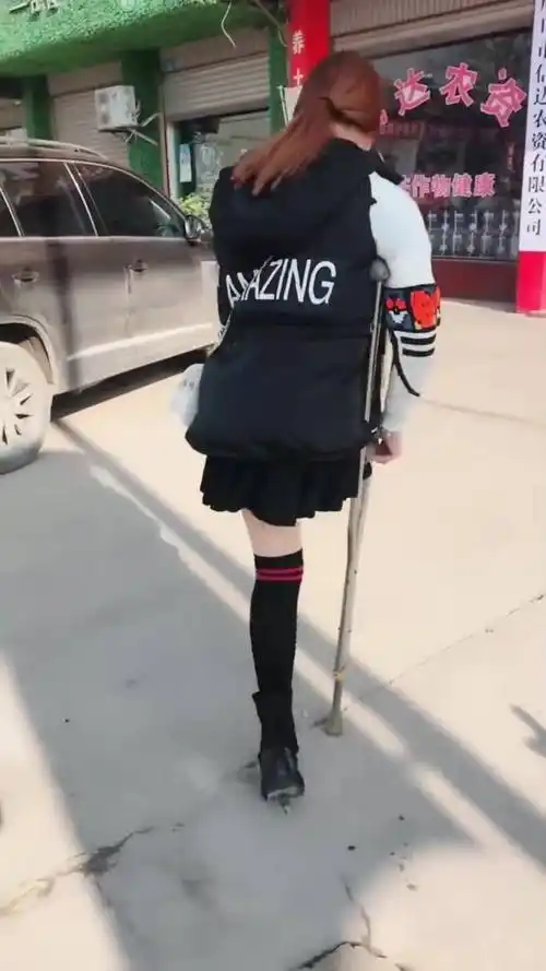 这个单腿妹子火了,笑起来真甜,网友励志女孩