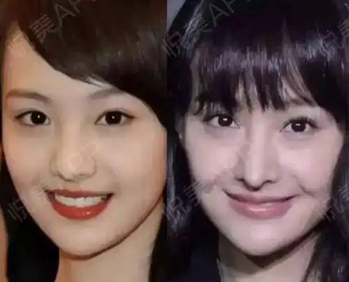 美商重要性杨幂居然靠少女感碾压了小她11岁关晓彤