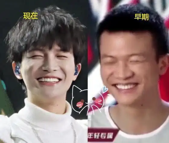 周深究竟有没有整容?3张图足以说明一切,这才是真相