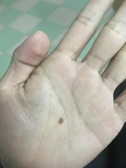 同时也意味着在后期你的运势会变得非常不错女人左手手心有痣,在日常