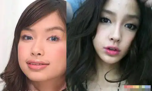 angelababy整容前后照片