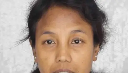 长期脸色暗黄怎么办分享给你三个方法扭转面色暗黄的问题