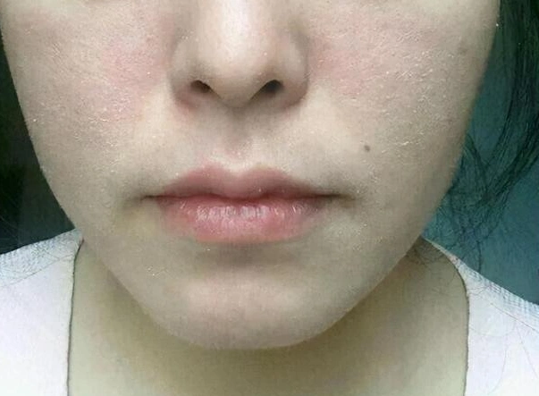 脸严重缺水用什么补水最有效?(超有用)|洁面皂|皮肤|甘油_新浪新闻