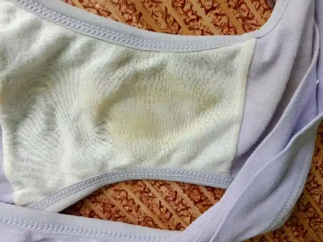 刚起床吃了饭 想上厕所 看见内裤湿,这样子会是羊水吗?