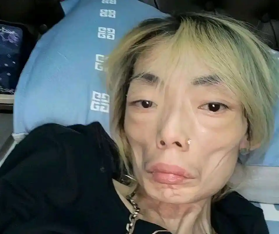 她严重失眠,脸色变得难看,像外星人一样苍白憔悴.