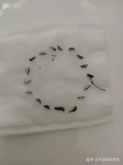 包皮术后记录分享