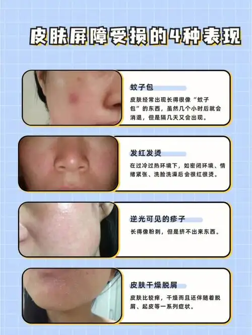 屏障受损的4⃣种表现,一张图教你自检!