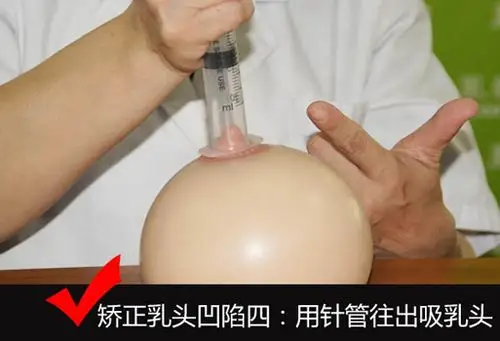 高级催乳师手把手教你解决乳头凹陷奶少烦恼